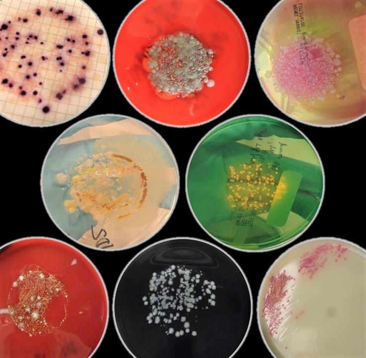 Eight cultured agar plates with colorful bacteria growing, arranged over black background
