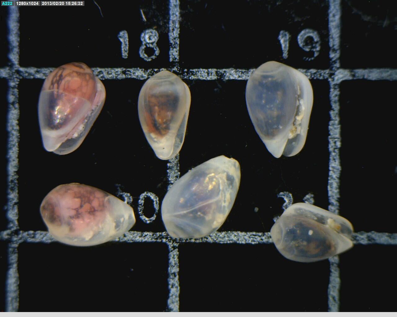 Digital microscope picture of gastropods (Gibberula lavalleeana) on a slide.