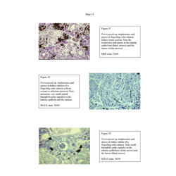 Histopathology - Plate 13 - Figures 37-39 thumb