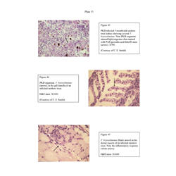 Histopathology - Plate 15 - Figures 43-45 thumb