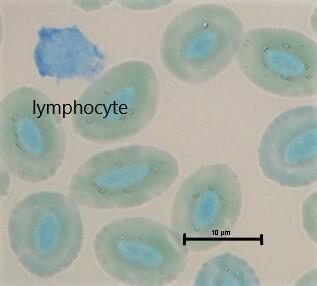MFU 5 Lymphocyte