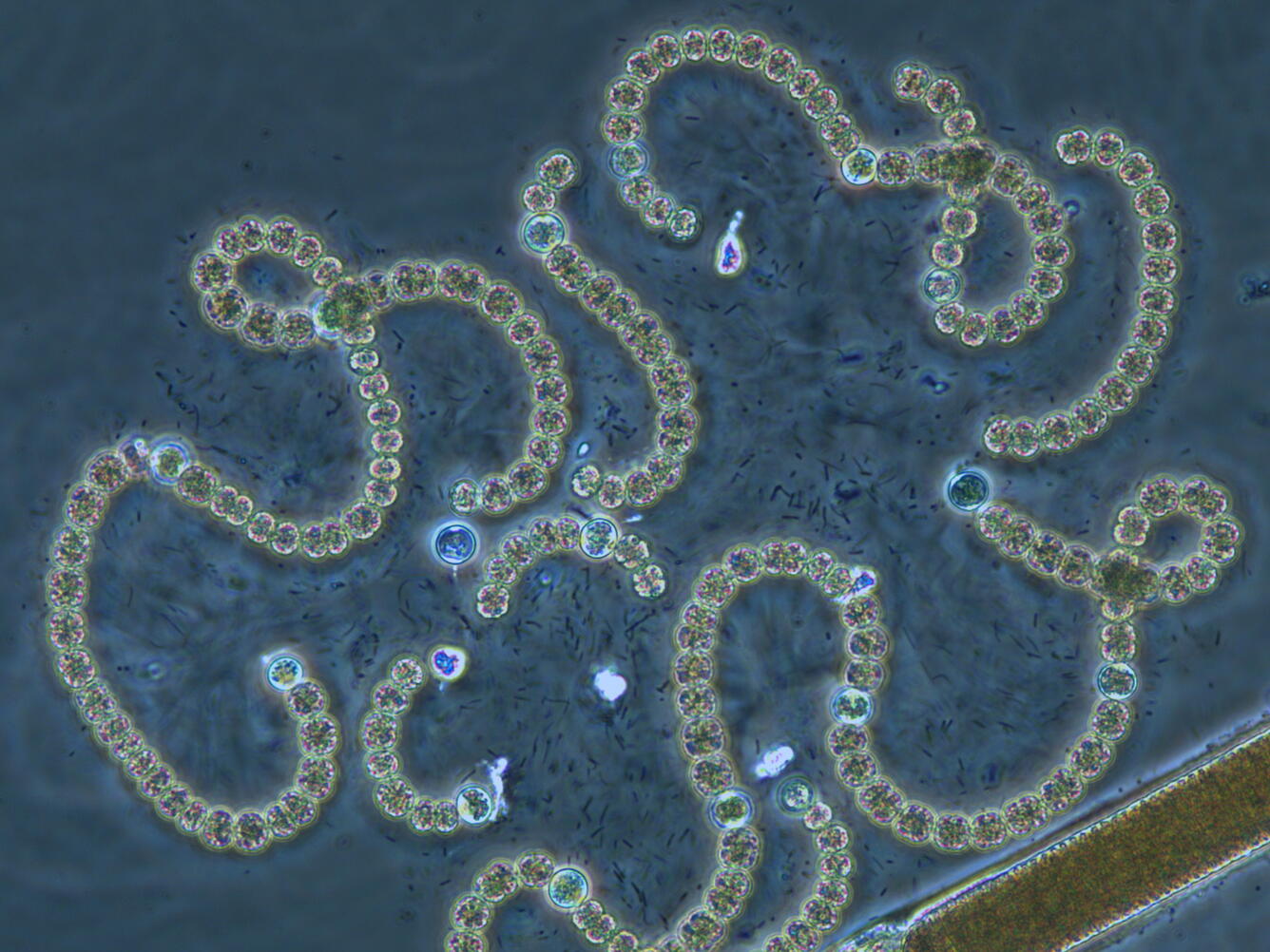 Microscopic photograph of the cyanobacteria Dolichospermum circinale cells in curved filaments
